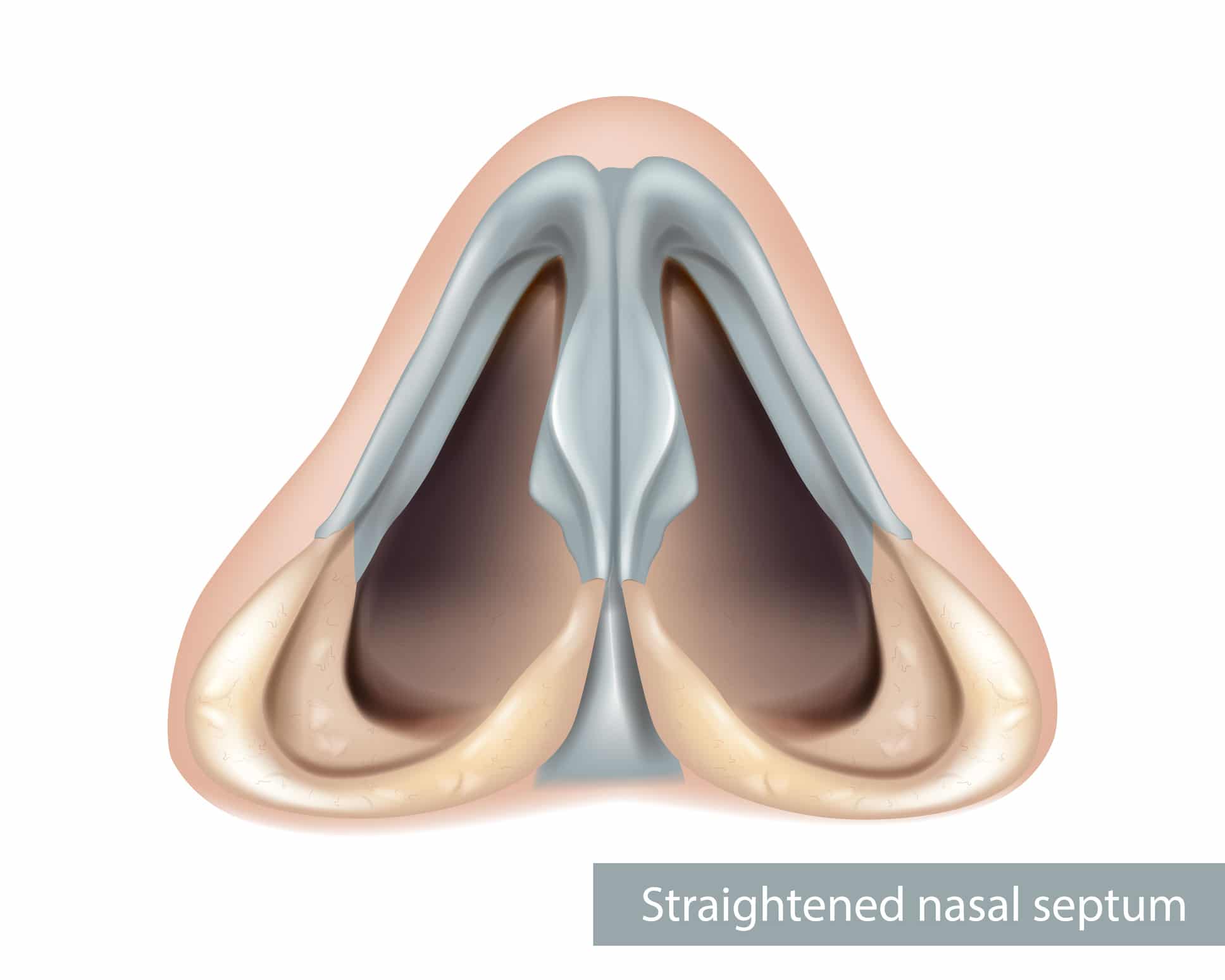 Featured image for “Deviated Septum and the VA: What Veterans Need to Know”